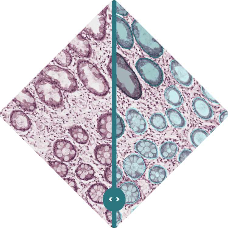 Pathology Image Analysis Services for Quantitative Research