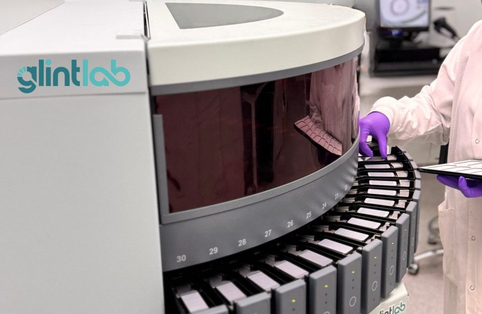Lab technician loading samples into a Glint Lab automated clinical analyzer in a modern laboratory.
