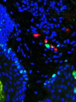 Multiplex IF Glint Lab