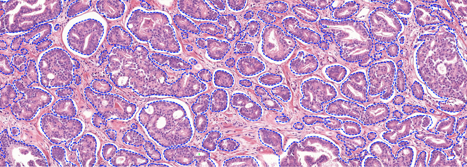H&E Morphology Analysis
